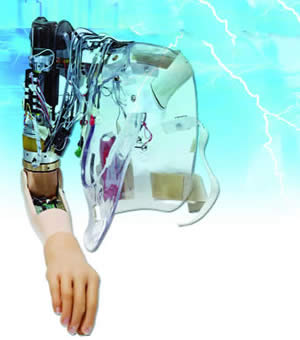 Bionika ruka