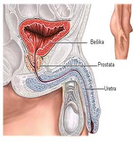 prostata bolovi